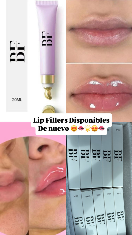 Lip filler